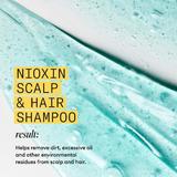 professzion-lis-er-s-t-sampon-t-redez-s-ellen-enyh-n-elv-konyodott-term-szetes-hajra-nioxin-system-1-scalp-hair-shampoo-300-ml-5.jpg