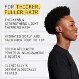 professzion-lis-t-r-sg-tl-k-szlet-enyh-n-ritkul-megjelen-s-term-szetes-hajhoz-subtiat-nioxin-system-1-scalp-hair-kit-150-ml-150-ml-50-ml-3.jpg
