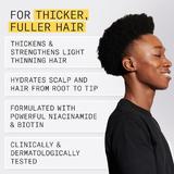 professzion-lis-t-r-sg-tl-term-kekszett-term-szetes-enyh-n-ritkul-megjelen-s-hajhoz-nioxin-system-1-scalp-hair-kit-300-ml-300-ml-100-ml-4.jpg